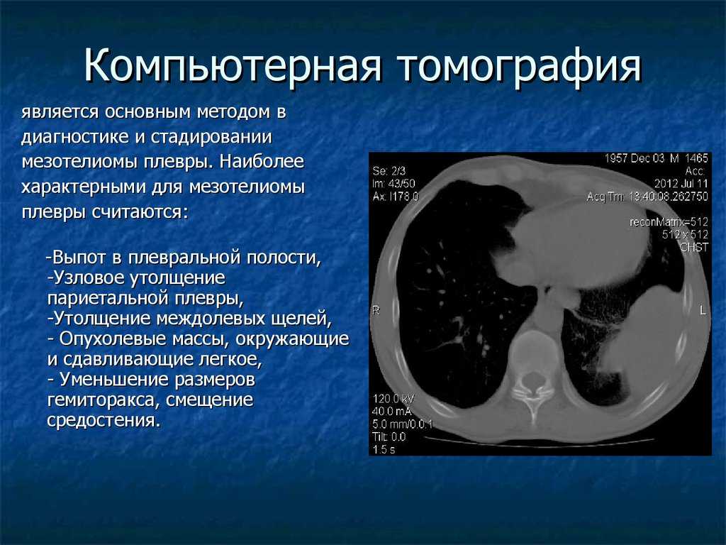 Что такое мягкотканная плотность