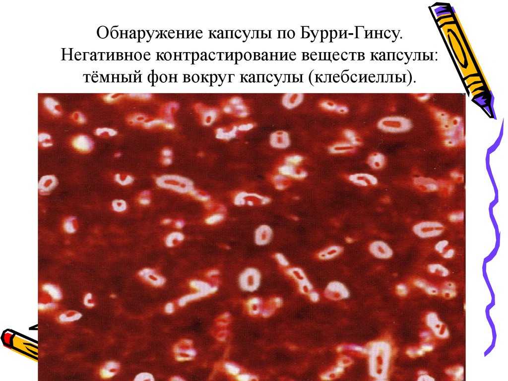 Сложные методы окраски микроорганизмов. сложные методы окраски бактерий, их применение. метод
выявления капсул: метод бурри-гинса