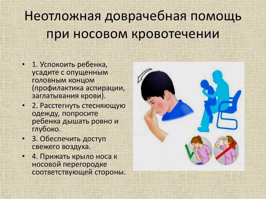 Как вызвать кровотечение из носа без боли - iealmed-klinika.ru