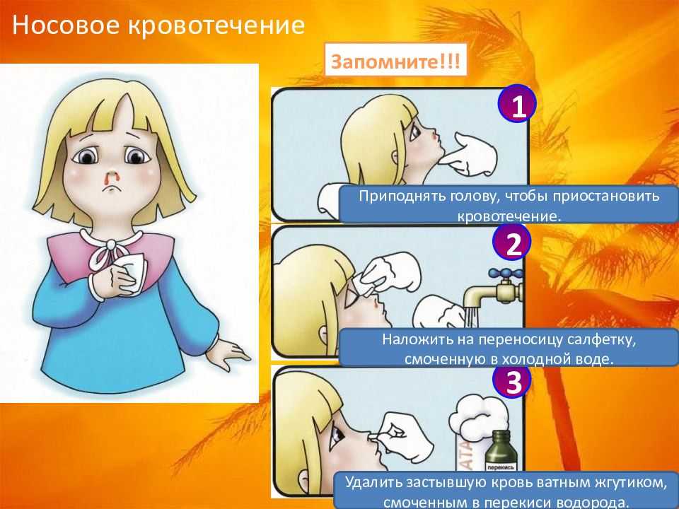 Как вызвать кровь из носа без боли: эффективные методы и советы
