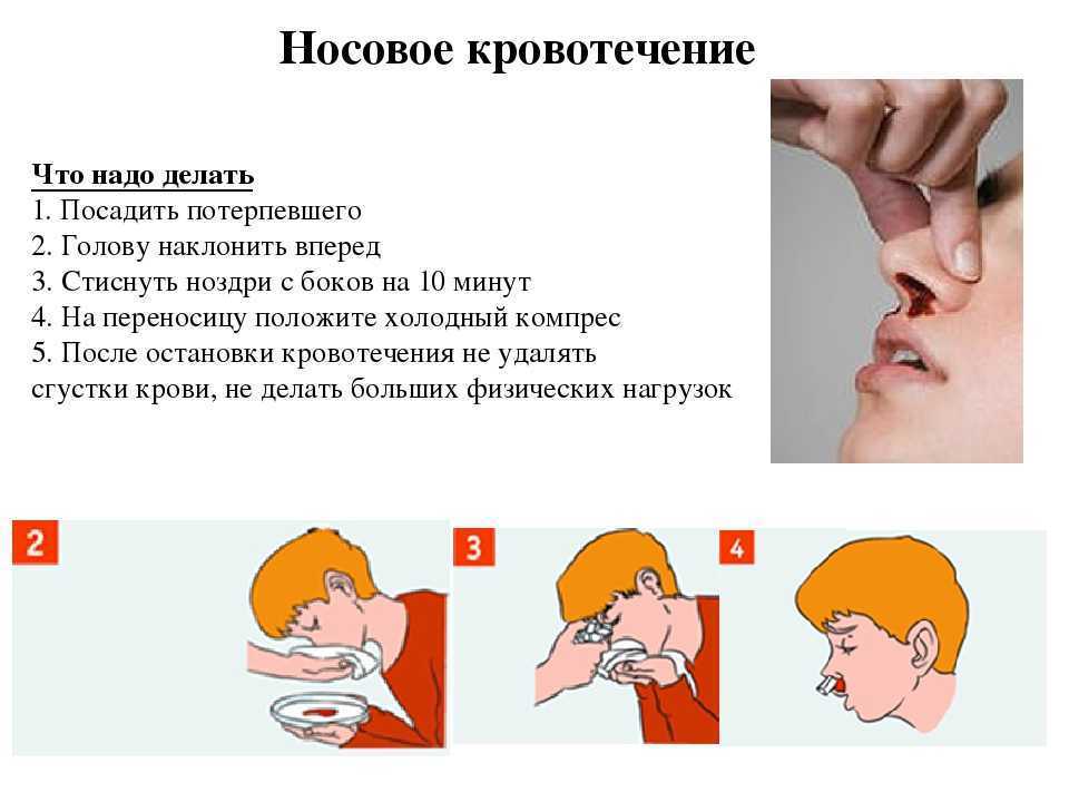 Как вызвать кровь из носа без боли самому себе — зачем это нужно