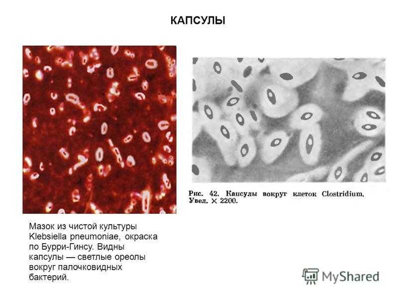 Окраска микроорганизмов
